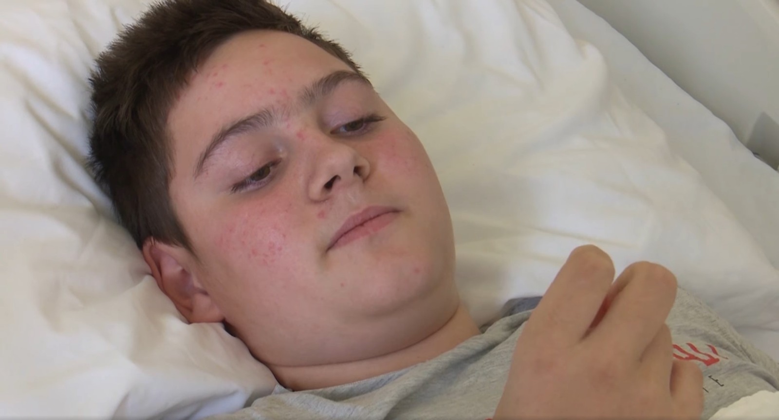 Băiat de 13 ani din Galaţi cu tumoră pe coloană, salvat la Iaşi