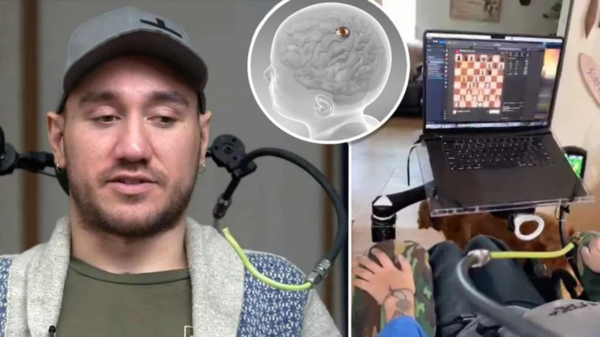 Un pacient Neuralink spune că implantul i-a oferit abilităţi incredibile în gaming