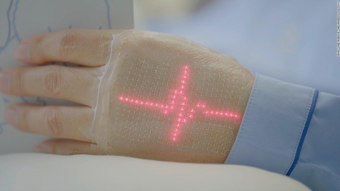 Pielea electronică care se autorepară în doar 10 secunde, o revoluţie în domeniul tehnologiei purtabile
