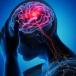 Studiu: Covid ar putea provoca inflamaţie cerebrală şi modificări similare Alzheimer