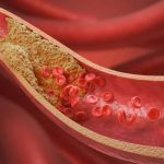 Colesterolul: ce rol are în organism şi când devine un risc pentru sănătate