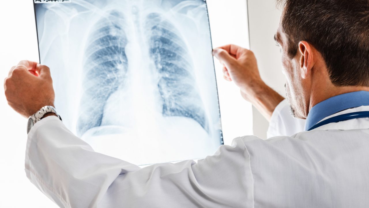 Boală rară, diagnostic întârziat: pacienţii cu hipertensiune pulmonară cer acces rapid la tratament