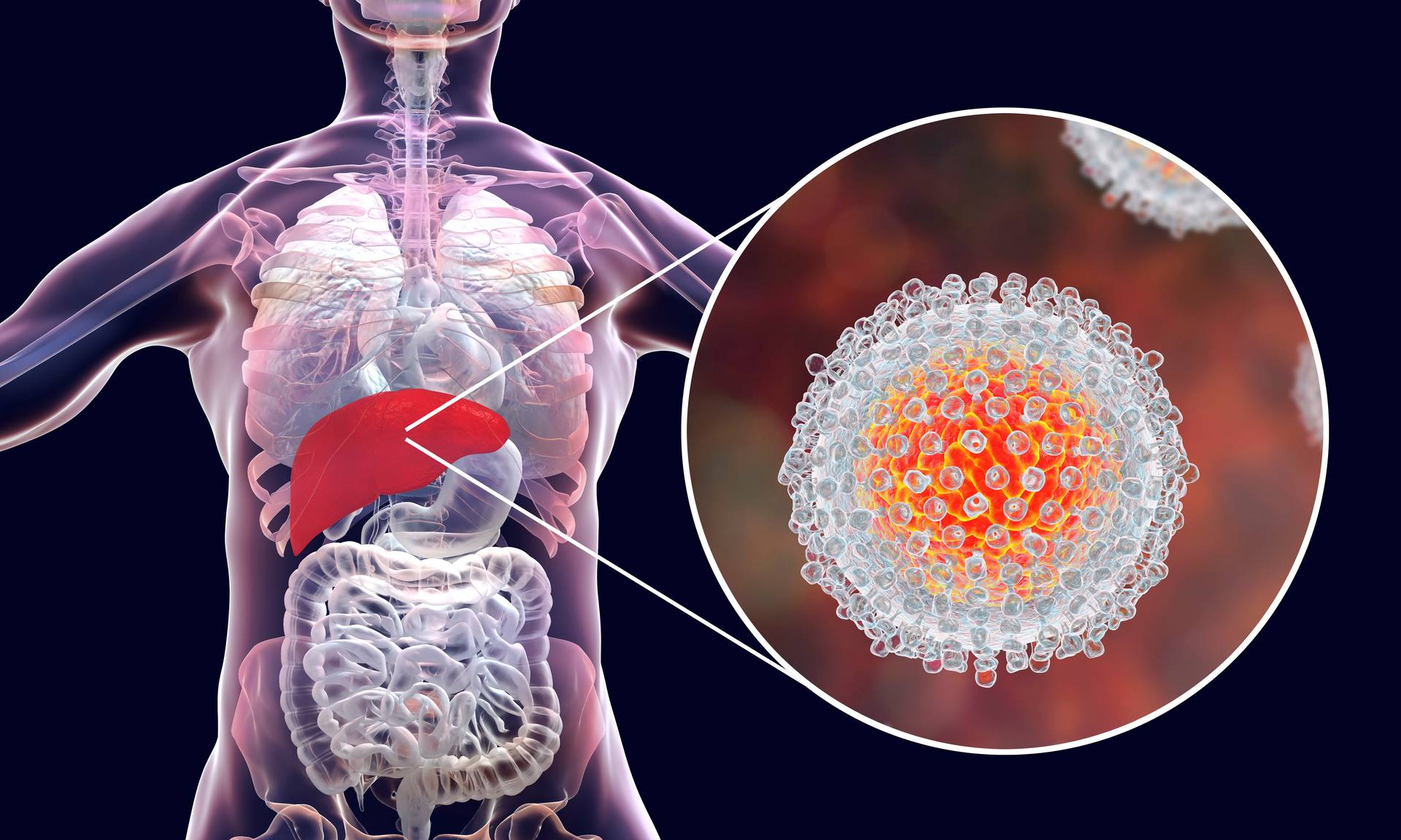 Medicul explică primele semne ale hepatitei şi cum poate fi prevenită boala
